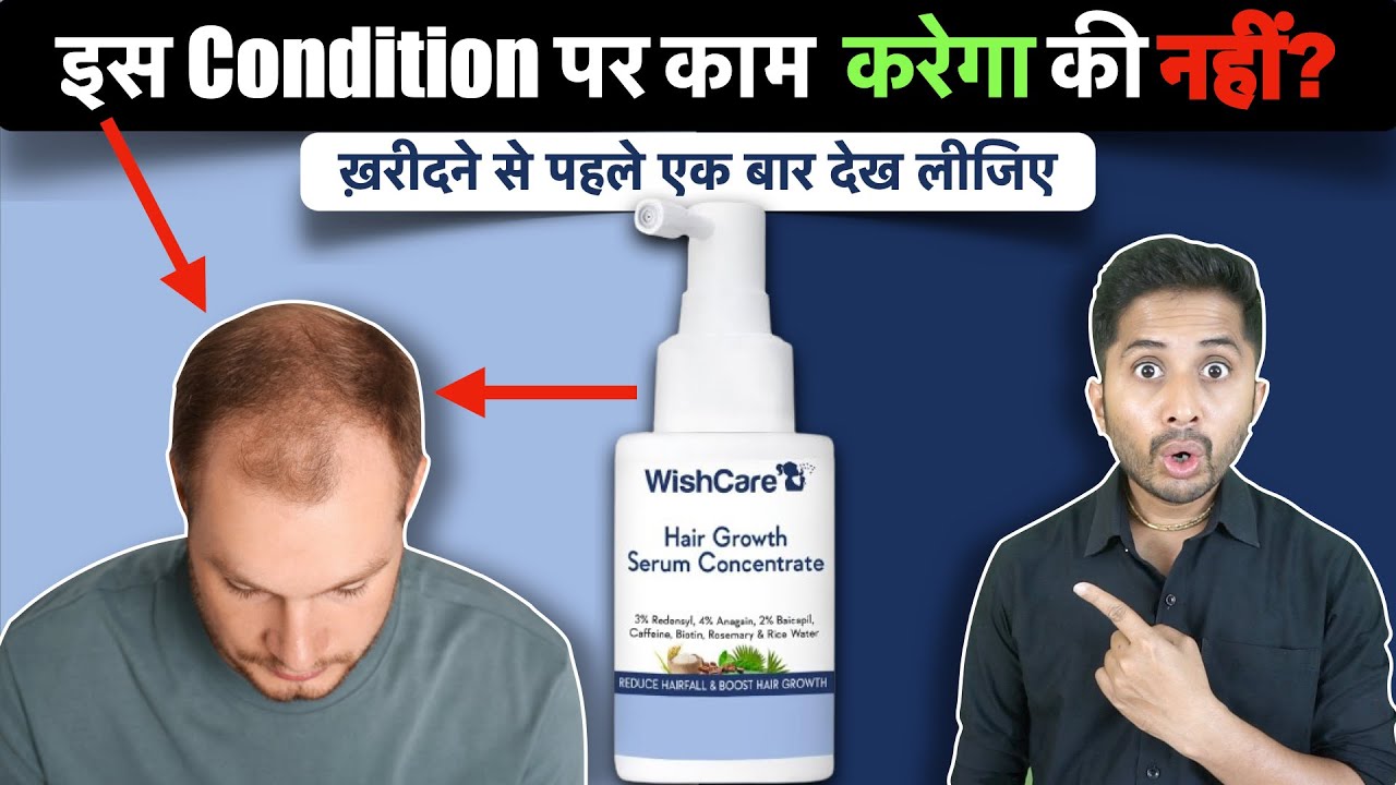 WishCare Hair Growth Serum Review - Will it Control Hair Fall?