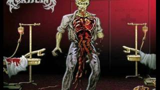 Mortician-Drilling For Brains