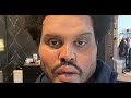 The Weeknd S New Face Sparks Fan Concern After Wearing Surgery Bandages