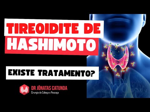 Existe tratamento para tireoidite de Hashimoto?