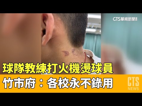 球隊教練打火機燙球員　竹市府：各校永不錄用