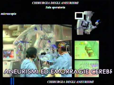 Ginocchio Istituto Vredena Dieta in gonartrosi al ginocchio grado congiunto 3