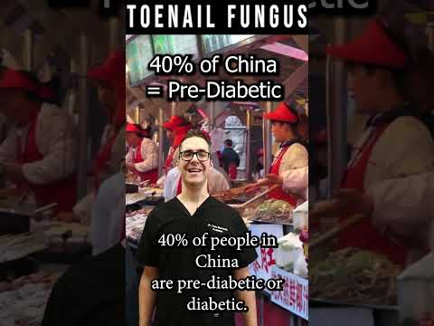 Skin Tag Removal Wart Removal How To Get Rid Of Skin Tags Warts