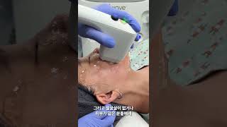 소프웨이브 성형 시술