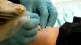 Raymond gets Bob tattoo!