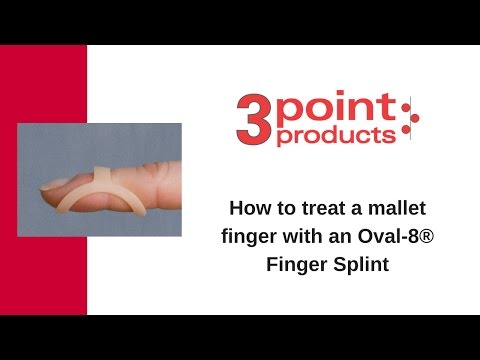 How to Treat a Mallet Finger with an Oval-8 Finger Splint - 3-Point Products