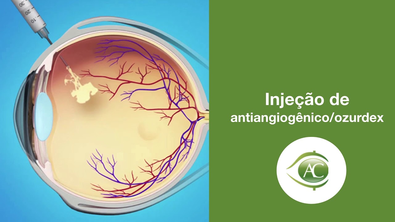 Aristófanes Canamary Jr.-16