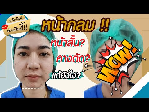 ร้อยไหม หน้าเรียว