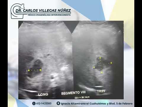 Carlos Enrique Villegas Nuñez-35