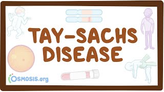 Tay-Sachs Disease Explained