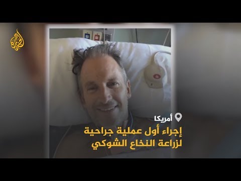 عملية جراحية لزراعة النخاع الشوكي