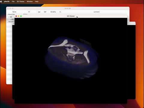 保健学科 PHORLIX Volume Rendering
