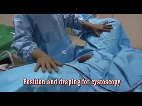 Uretroplastyka - ułożenie pacjenta i cystoskopia 