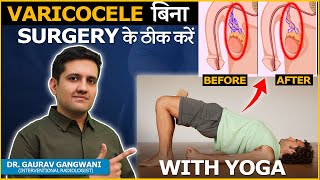 Download lagu Yoga for Varicocele: Relieve Pain and Promote Circulation | Dr. Gaurav Gangwani mp3