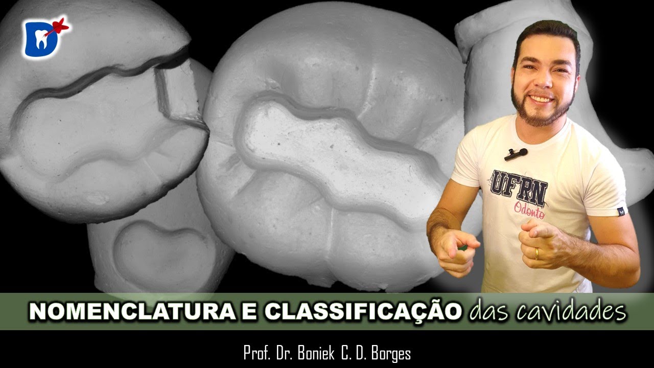 NOMENCLATURA E CLASSIFICAÇÃO DAS CAVIDADES