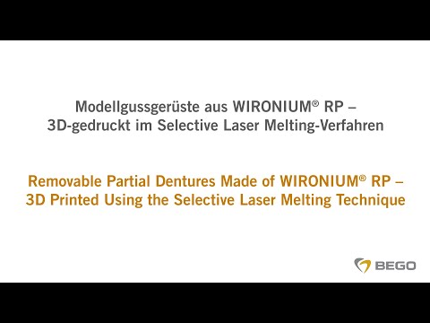 BEGO Selective Laser Melting – Removable Partial Denture Frameworks made of WIRONIUM® RP