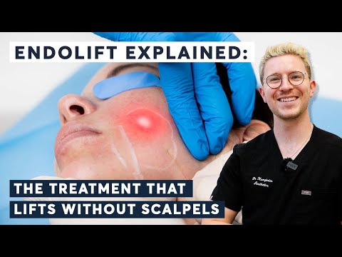 Endolift erklärt: Die Laserbehandlung, die ohne Skalpell strafft