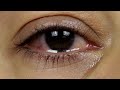 Crying Woman Eye With Tears Hd By Creator Stockify