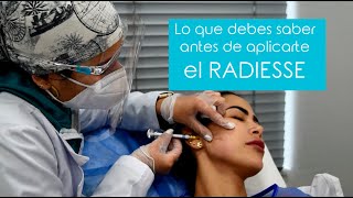 Preguntas y respuestas que debes escuchar antes de aplicarte el RADIESSE