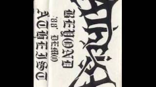 Atheist-Brain Damage