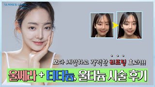 이중턱 피부처짐 고민 해결!! 울타늄 시술 후기