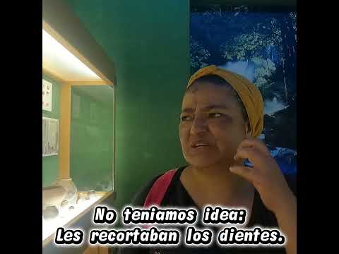 😁🫣 Les recortaban los dientes.🫨😲🙊🙊