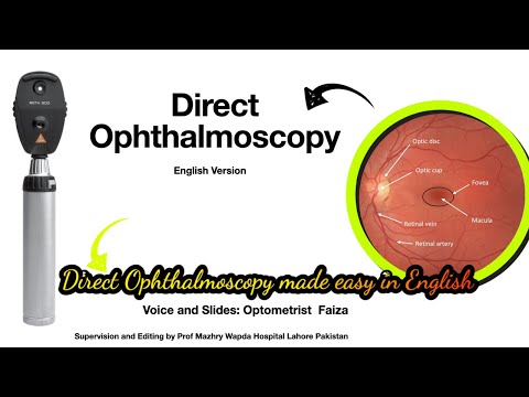 Direct Ophthalmoscopy technique made easy-English-1