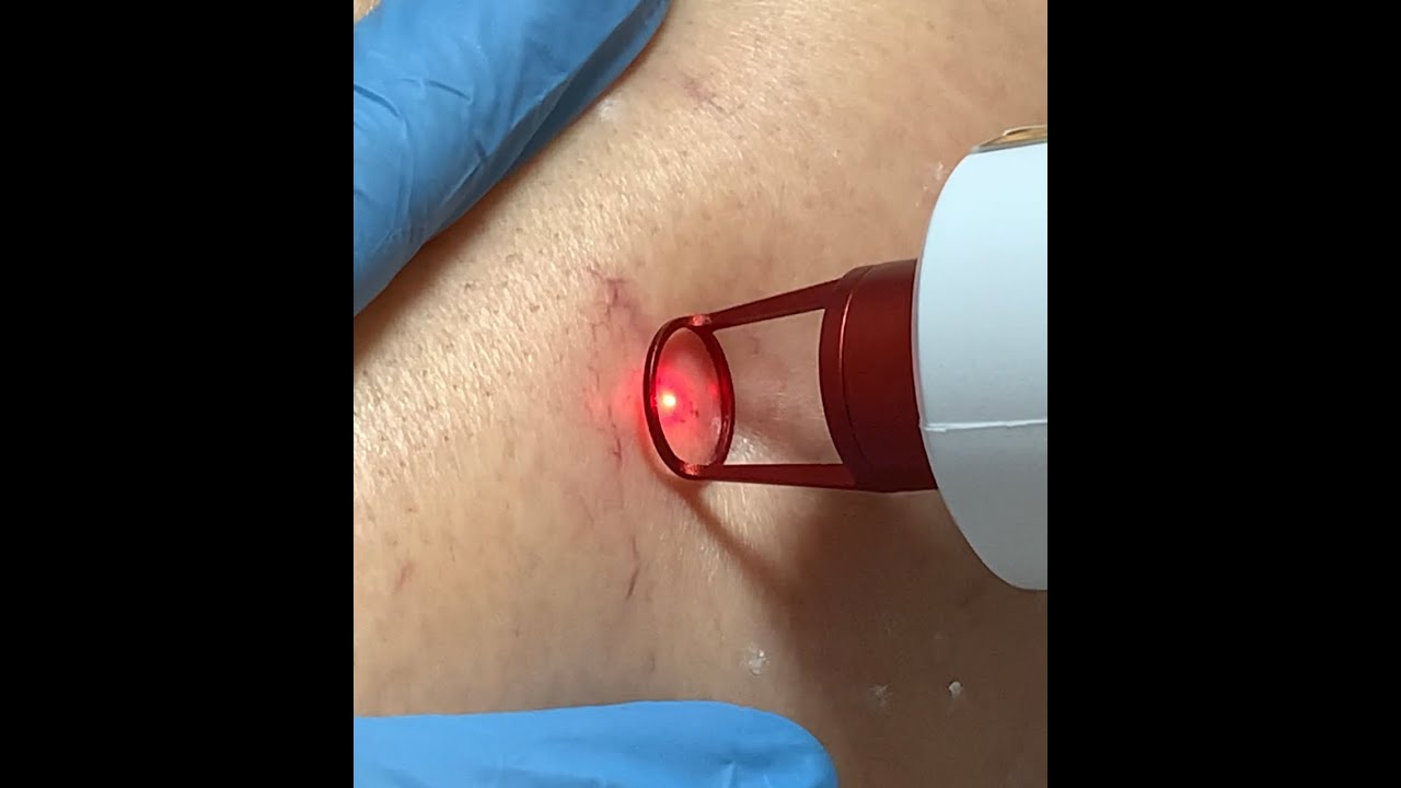 Jaison Luiz Argenta-12