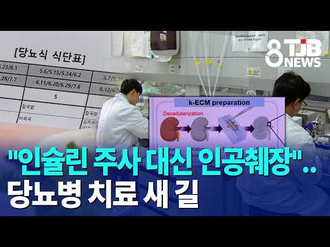 &#034;인슐린 주사 대신 인공췌장&#034;..당뇨병 치료 새 길｜ TJB 대전·세종·충남뉴스