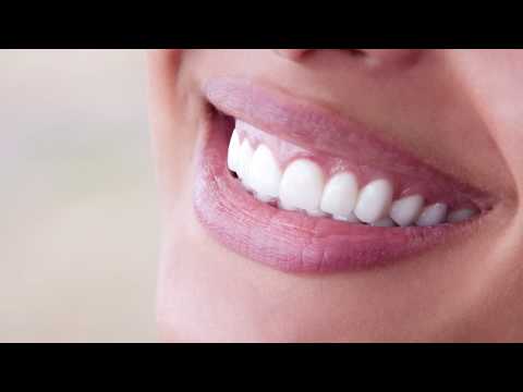 FAQ - What are veneers? | Ronald Moreno, DDS | Moreno and Young Dental