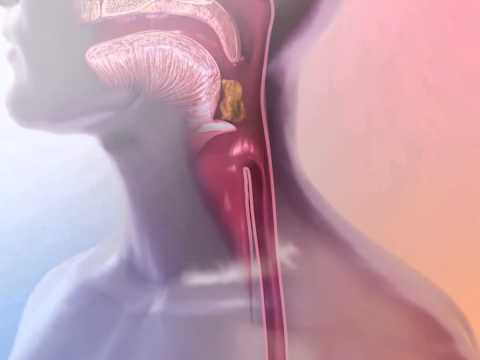 Learn@Visible Body - Peristalsis