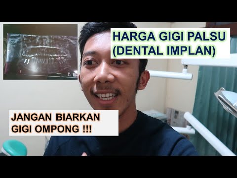 , title : 'Pengalaman Implan Gigi - Solusi Untuk Gigi Ompong - Harga Implan Gigi'