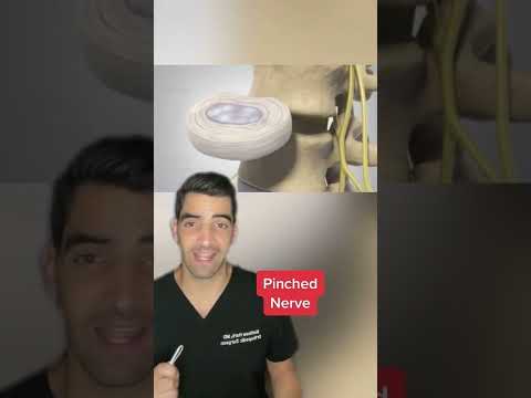 Eingeklemmter Nerv im Rücken