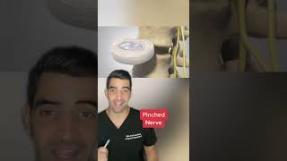 Download lagu Pinched nerve in the back mp3