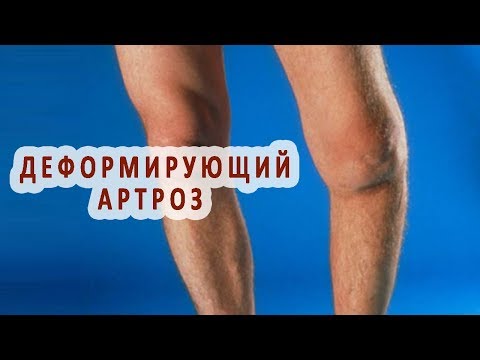 Лимфоузлы на шее у ребенка детей лечение Лечение при пролапсе позвоночника