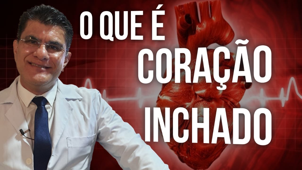 INSUFICIÊNCIA CARDÍACA, o que é como prevenir O Famoso Coração Inchado - Dr. Manoel Paz Landim