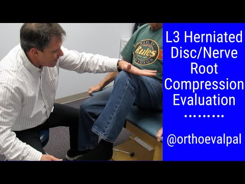 L4 Nerve Root Compression Evaluation with Paul Marquis PT