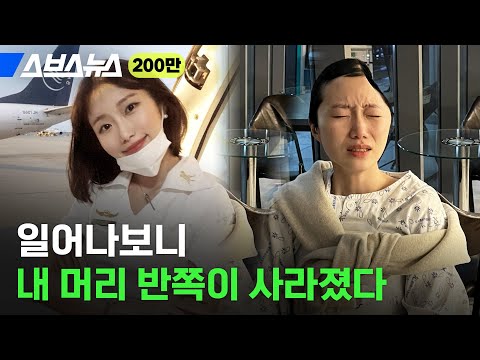 길에서 넘어졌다가 '머리뼈'까지 제거한 사연 / 스브스뉴스