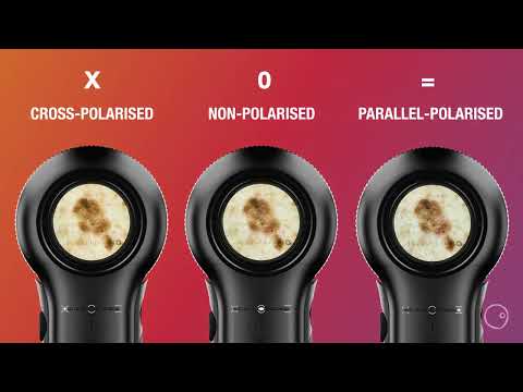 DermLite DL5 Dermatoscope | The perfect solution to all your dermoscopy needs