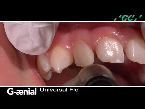 Orthodontic Space Management