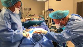 Rhinoplasty at BHPS by Dr. Chiu