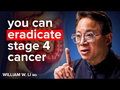 “This Kills Stage 4 Cancer Cells!” - How To STARVE & Prevent Colon Cancer! | Dr. William Li