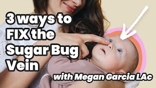 3 Ways to FIX the Sugar Bug Vein