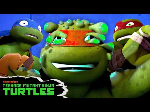 Mikey Breaks Out In Pimples! 😱 | Full Episode in 5 Minutes | Teenage Mutant Ninja Turtles