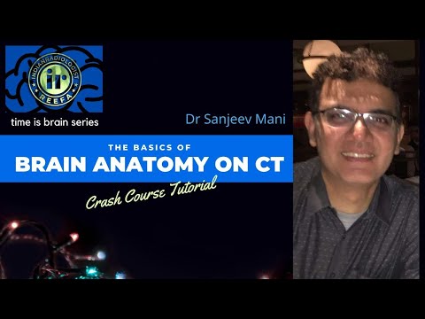 TIME IS BRAIN SERIES | CT BRAIN - ANATOMY TUTORIAL | DR SANJEEV MANI | NEUROPARENCHYMA & VENTRICLES