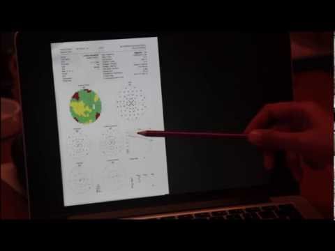 Hanny- Indonesia - Retinitis Pigmentosa Treatment - Part 2 - Medical Results (in indenosian)