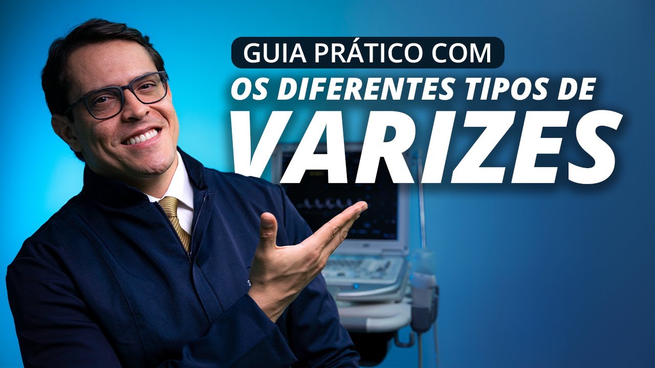 Conhecendo os TIPOS DE VARIZES: Guia Resumido com o Dr. Bruno Canguçu