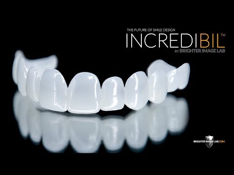 IncrediBIL Veneers® Better Than a Cosmetic Dentist? Smile Transformation by Brighter Image Lab