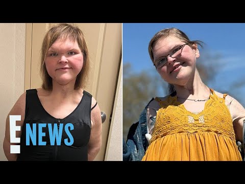 Tammy Slaton Shows Off Figure in Shapewear After Skin Removal Surgery | E! News