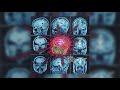Ship Wrek - Stimulate Ship Wrek - Stimulate